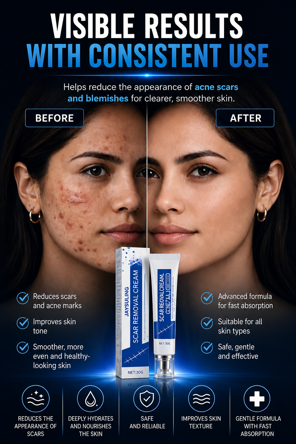 Advanced Silicone Scar Gel and Scar Removal Cream